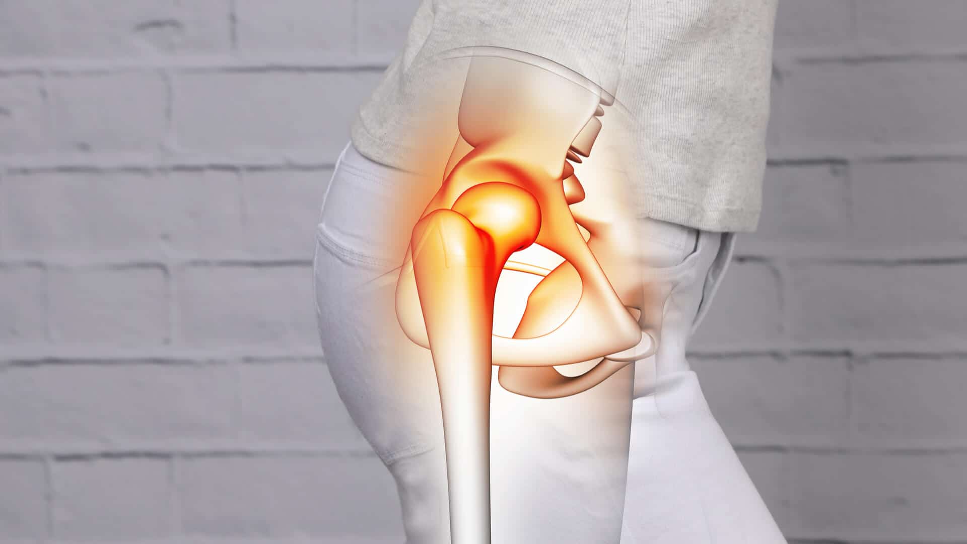 Hip implant failure symptoms