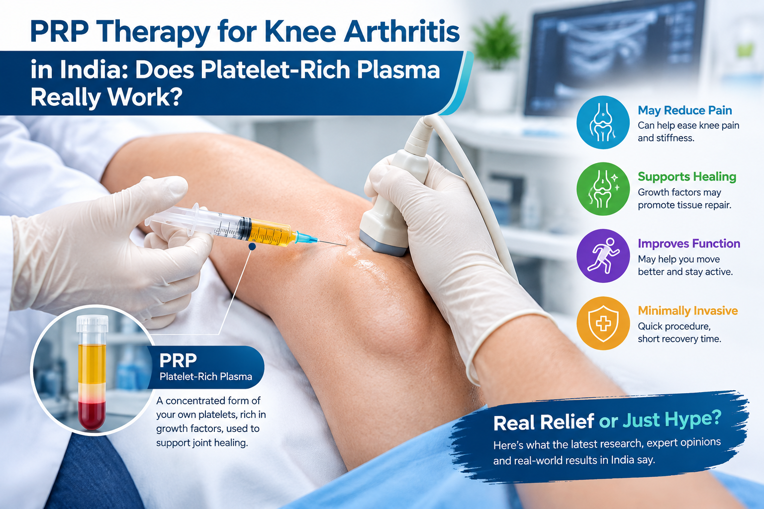 PRP therapy injection for knee arthritis showing platelet-rich plasma treatment for knee pain in Surat